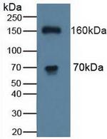 ATP7B Antibody in Western Blot (WB)