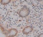 ABCA12 Antibody in Immunohistochemistry (Paraffin) (IHC (P))