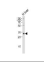 SULT2A1 Antibody in Western Blot (WB)