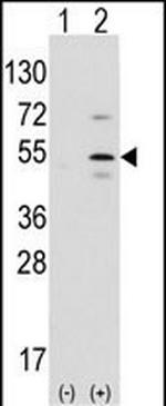 PTF1A Antibody in Western Blot (WB)