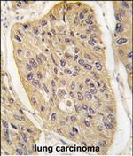 WIF1 Antibody in Immunohistochemistry (Paraffin) (IHC (P))