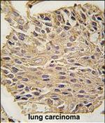 Aldolase A Antibody in Immunohistochemistry (Paraffin) (IHC (P))