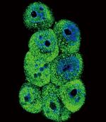 AKR1B1 Antibody in Immunocytochemistry (ICC/IF)