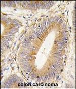 AKR1B1 Antibody in Immunohistochemistry (Paraffin) (IHC (P))