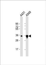 AKR1B1 Antibody in Western Blot (WB)