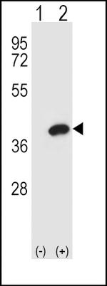 AKR1B1 Antibody in Western Blot (WB)