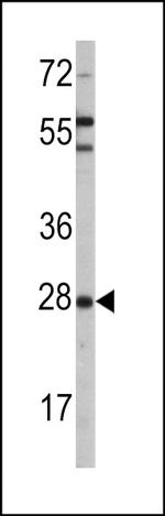 Sigma-1 Receptor Antibody in Western Blot (WB)