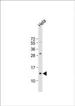 beta-2 Microglobulin Antibody in Western Blot (WB)