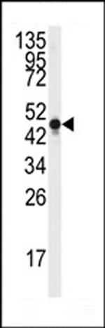 NSE Antibody in Western Blot (WB)