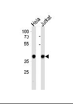 NPM1 Antibody in Western Blot (WB)