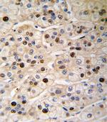 PCNA Antibody in Immunohistochemistry (Paraffin) (IHC (P))