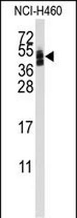 CAR Antibody in Western Blot (WB)