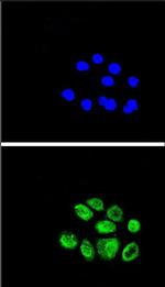 EXO1 Antibody in Immunocytochemistry (ICC/IF)