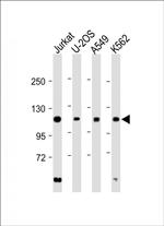 EXO1 Antibody in Western Blot (WB)