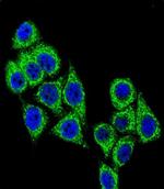 CD38 Antibody in Immunocytochemistry (ICC/IF)