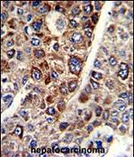 CD38 Antibody in Immunohistochemistry (Paraffin) (IHC (P))