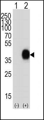 CD38 Antibody in Western Blot (WB)