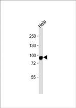 CD105 Antibody in Western Blot (WB)