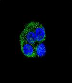 CD36 Antibody in Immunocytochemistry (ICC/IF)