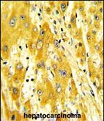 CD36 Antibody in Immunohistochemistry (Paraffin) (IHC (P))