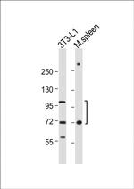 CD36 Antibody in Western Blot (WB)