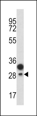 EPCR Antibody in Western Blot (WB)