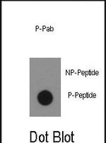 Phospho-c-Abl (Tyr134) Antibody in Dot Blot (DB)