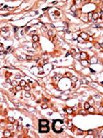 Phospho-c-Abl (Tyr134) Antibody in Immunohistochemistry (Paraffin) (IHC (P))