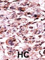 Phospho-c-Abl (Tyr245) Antibody in Immunohistochemistry (Paraffin) (IHC (P))