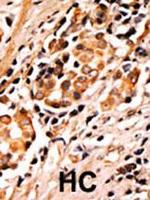 Phospho-BAD (Ser75) Antibody in Immunohistochemistry (Paraffin) (IHC (P))