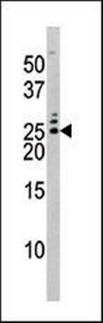 Phospho-BAD (Ser75) Antibody in Western Blot (WB)