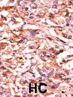 Phospho-Cdc25B (Ser187) Antibody in Immunohistochemistry (Paraffin) (IHC (P))