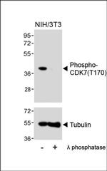 Phospho-CDK7 (Thr170) Antibody in Western Blot (WB)