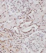 Phospho-ErbB4 (Tyr1188) Antibody in Immunohistochemistry (Paraffin) (IHC (P))