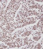 Phospho-ErbB4 (Tyr1188) Antibody in Immunohistochemistry (Paraffin) (IHC (P))