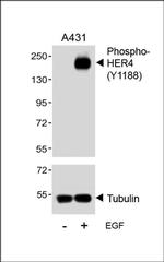 Phospho-ErbB4 (Tyr1188) Antibody in Western Blot (WB)