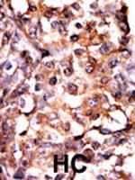 Phospho-MAPKAPK2 (Ser272) Antibody in Immunohistochemistry (Paraffin) (IHC (P))