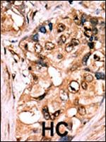 Phospho-MEK1 (Ser218, Ser222) Antibody in Immunohistochemistry (Paraffin) (IHC (P))