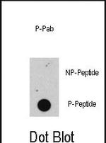 Phospho-Rb (Ser608) Antibody in Dot Blot (DB)