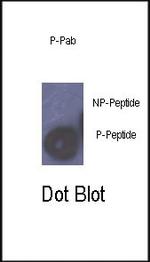 Phospho-Rb (Ser780) Antibody in Dot Blot (DB)