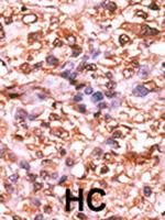 Phospho-Rb (Ser788) Antibody in Immunohistochemistry (Paraffin) (IHC (P))