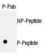 Phospho-Rb (Ser811) Antibody in Dot Blot (DB)