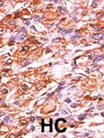 Phospho-Rb (Ser811) Antibody in Immunohistochemistry (Paraffin) (IHC (P))