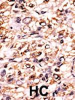 Phospho-Separase (Ser1126) Antibody in Immunohistochemistry (Paraffin) (IHC (P))