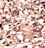 Phospho-TNFR1 (Ser274) Antibody in Immunohistochemistry (Paraffin) (IHC (P))