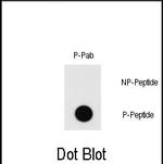 Phospho-MEF2C (Thr20) Antibody in Dot Blot (DB)