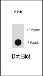 Phospho-B-Raf (Thr598) Antibody in Dot Blot (DB)