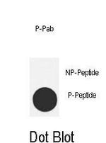 Phospho-MDM2 (Thr218) Antibody in Dot Blot (DB)