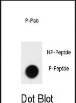 Phospho-CD150 (Tyr281) Antibody in Dot Blot (DB)