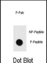 Phospho-MBP (Tyr203) Antibody in Dot Blot (DB)